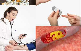 Xơ vữa động mạch ngoại biên: Nguyên nhân, triệu chứng, phòng bệnh và cách điều trị
