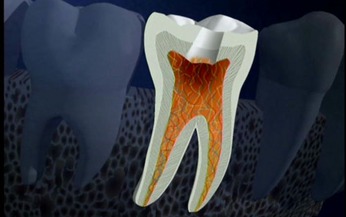 Cách phòng bệnh viêm tủy xương hàm