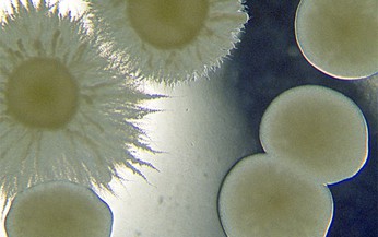 Thuốc nào trị nấm màng não do Crytococcus?