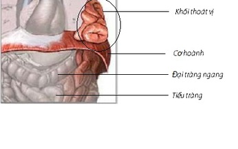 Tho&#225;t vị ho&#224;nh bẩm sinh - Tỉ lệ sống thấp, v&#236; sao?