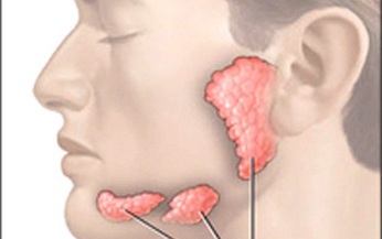 Biểu hiện ung thư tuyến nước bọt