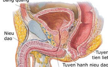 Vi&#234;m tuyến tiền liệt do vi khuẩn