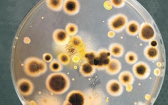 Ph&#242;ng ngừa vi&#234;m phổi do nhiễm vi khuẩn Legionella