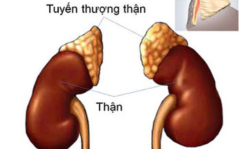 Hạn chế suy tuyến thượng thận thế n&#224;o?