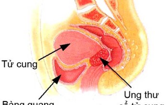 10 nguy&#234;n nh&#226;n g&#226;y cường kinh