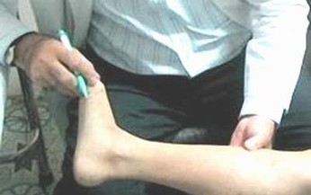 Viêm xương tủy đường máu