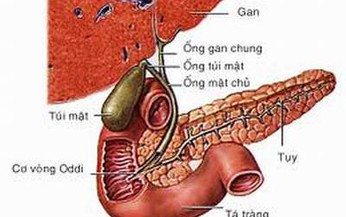 Vi&#234;m t&#250;i mật c&#243; nguy hiểm?