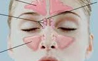 Ph&#236; đại cuốn mũi chữa thế n&#224;o?