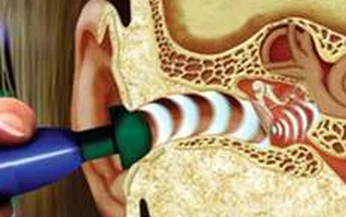 Điếc c&#226;m v&#224; c&#225;ch ph&#225;t hiện sớm