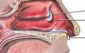 Thuốc điều trị bệnh suy giảm khứu gi&#225;c