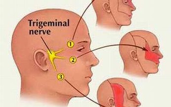 Thuốc trị đau d&#226;y thần kinh sinh ba