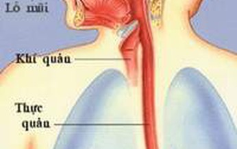 Co thắt thực quản lan tỏa d&#249;ng thuốc g&#236;?