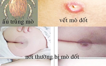 Cảnh gi&#225;c với sốt m&#242;