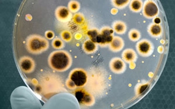 Cảnh b&#225;o bệnh vi&#234;m phổi cấp do Legionella