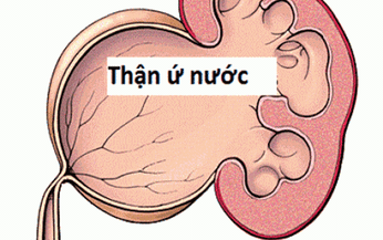 B&#224;i thuốc trị thận ứ nước