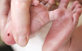 V&#236; sao trẻ bị thiếu men G6PD?