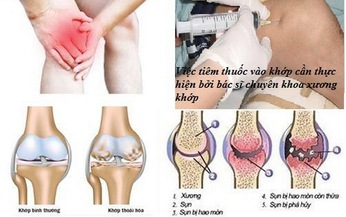 Những sai lầm khi d&#249;ng thuốc chữa bệnh xương khớp