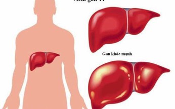 Cách phòng ngừa viêm gan A