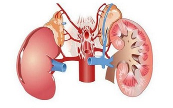 Vi&#234;m cầu thận mạn t&#237;nh c&#243; đ&#225;ng lo?