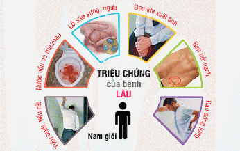 Hệ lụy nguy hiểm của bệnh lậu