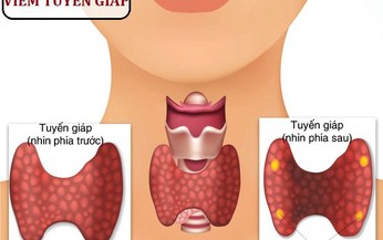 Nguy&#234;n nh&#226;n n&#224;o g&#226;y suy gi&#225;p ở trẻ em?