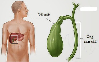 Khi nào nên cắt túi mật?