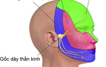 Chẩn đo&#225;n nguy&#234;n nh&#226;n đau thần kinh sinh ba