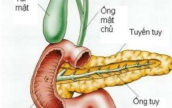 Nguy&#234;n nh&#226;n g&#226;y ra vi&#234;m tụy cấp