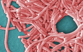 Bệnh vi&#234;m phổi do nhiễm vi khuẩn Legionella