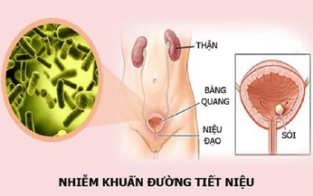 Nhận biết, ph&#242;ng ngừa nhiễm tr&#249;ng tiết niệu