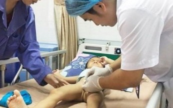 Những phương ph&#225;p điều trị s&#249;i m&#224;o g&#224; ở trẻ em