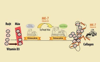 Bệnh c&#242;i xương ở trẻ em