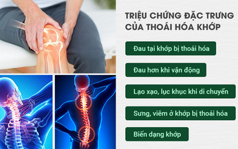 Phương ph&#225;p khắc phục khớp vi&#234;m đau v&#224; tho&#225;i h&#243;a hiệu quả