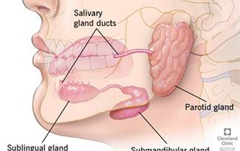 Vi&#234;m tuyến nước bọt do răng: Nguy&#234;n nh&#226;n v&#224; giải ph&#225;p điều trị