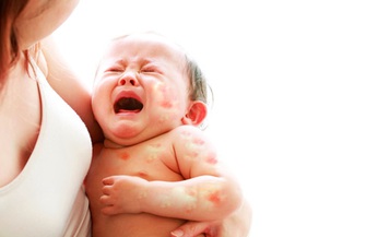 Cách chăm sóc trẻ em bị dị ứng sữa bò