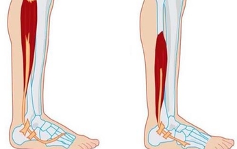 Thuốc đầu ti&#234;n trị bệnh teo cơ Duchenne