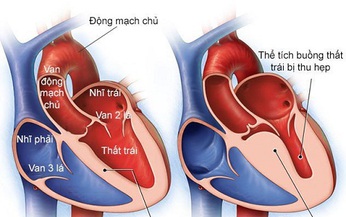 Loại thuốc mới c&#243; thể gi&#250;p cải thiện chức năng tim