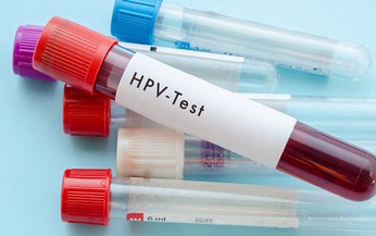 Khuyến nghị mới về x&#233;t nghiệm HPV để tầm so&#225;t ung thư cổ tử cung