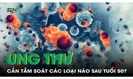 Từ 50 tuổi cần tầm so&#225;t c&#225;c loại ung thư n&#224;o?
