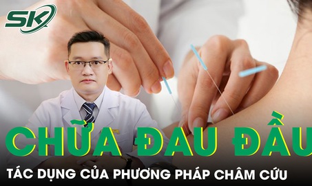 C&#225;c t&#225;c dụng của phương ph&#225;p ch&#226;m cứu trong chữa đau đầu