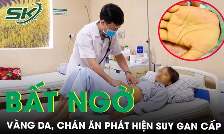 Da vàng như nghệ, ăn uống kém, bất ngờ phát hiện suy gan cấp, nguy cơ lây cao