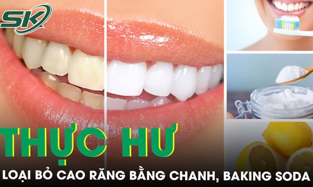 Thực hư loại bỏ cao răng bằng chanh, baking soda