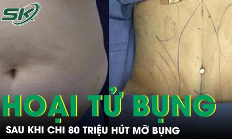 Chi 80 triệu làm đẹp, người phụ nữ hoại tử bụng sau khi hút mỡ
