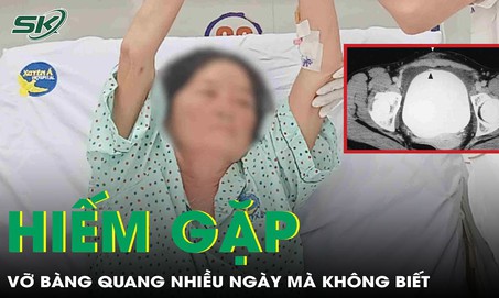 Hi hữu người phụ nữ vỡ b&#224;ng quang nhiều ng&#224;y m&#224; kh&#244;ng biết