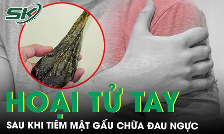 Tiêm mật gấu chữa đau ngực, người đàn ông hoại tử cánh tay suýt mất mạng