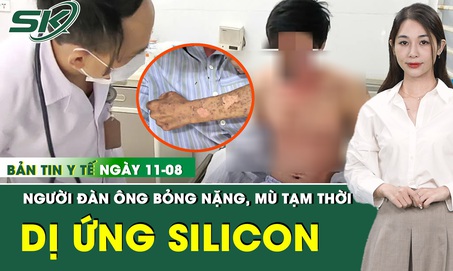 Bản Tin Y Tế 11/8: Người đàn ông bỏng nặng, mù tạm thời do dị ứng silicon