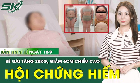 Bản Tin Y Tế 16/9: Tăng 20kg, giảm 6cm chiều cao, b&#233; g&#225;i được chẩn đo&#225;n mắc hội chứng hiếm gặp