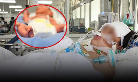 Em bé 27 tuần tử vong sau khi đẻ rơi tại nhà, mẹ sốc mất máu