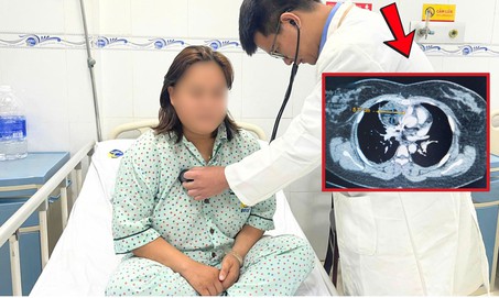 Đột ngột khó thở, cô gái 27 tuổi nhập viện phát hiện u quái trung thất