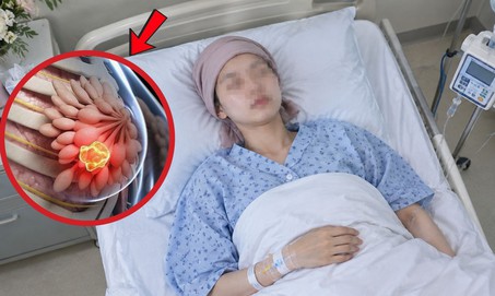 Cô gái mới 19 tuổi đã mắc ung thư vú, hối hận vì bỏ qua điều này